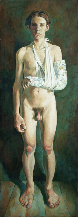 L’Aile casser <span>🔴</span>
